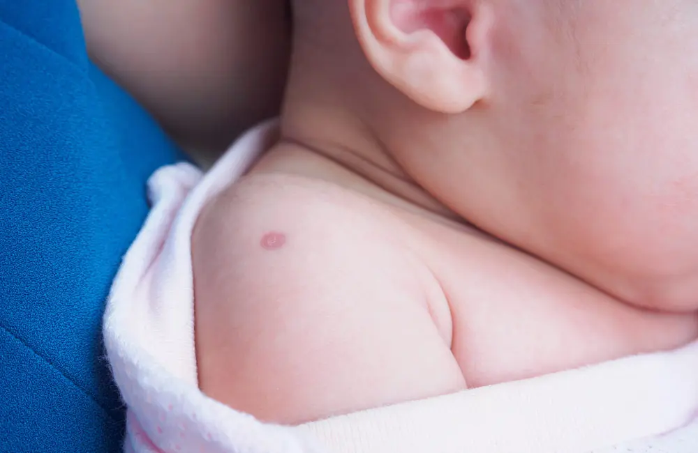 ทำไมต้องฉีดวัคซีนให้ทารกแรกเกิด