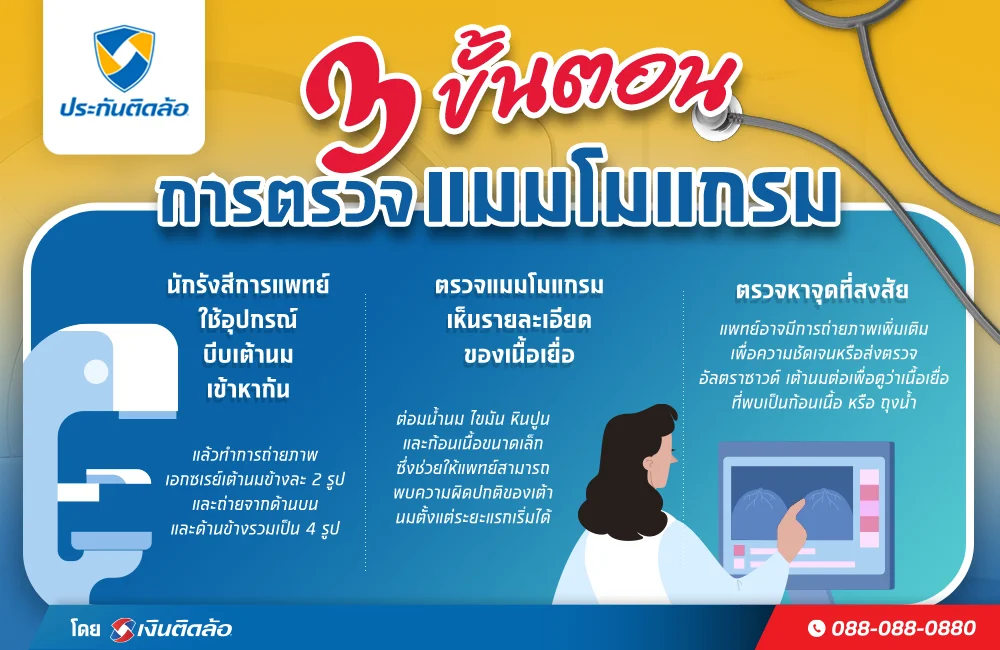 ขั้นตอนการตรวจแมมโมแกรม